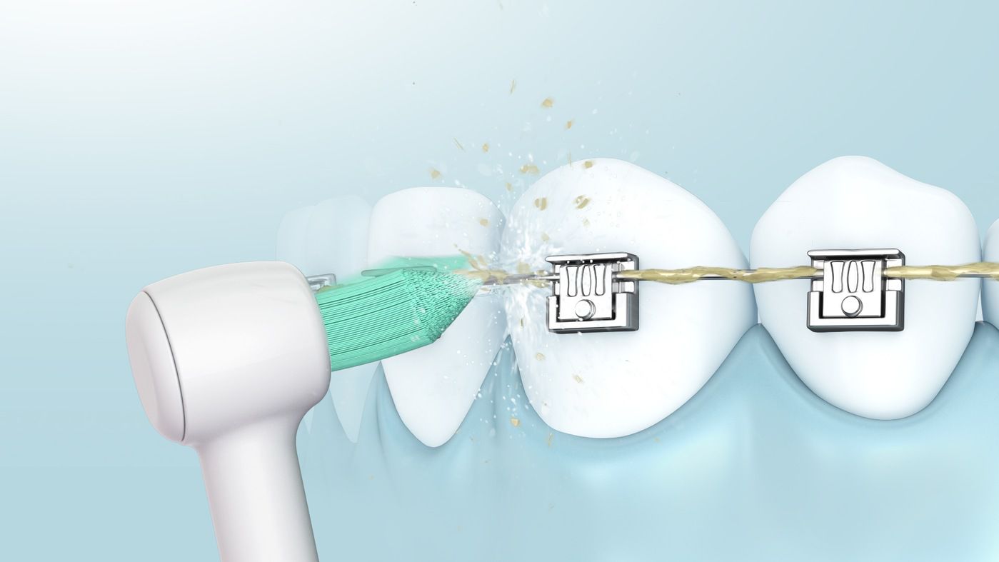 Panasonic Buse de rechange WEW0984 (2)